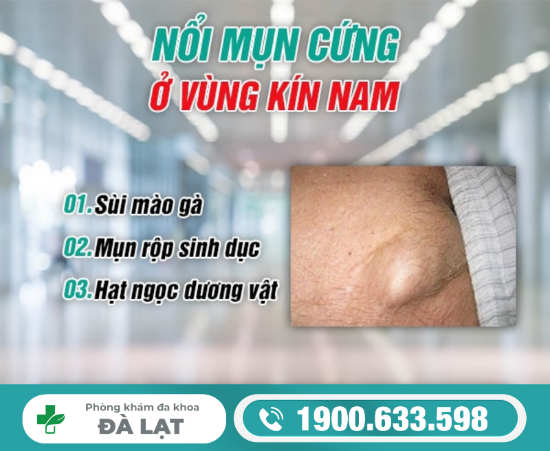 Hình ảnh minh họa